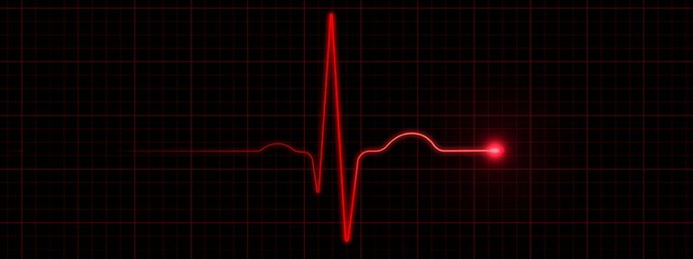 Darstellung Herzfrequenz auf schwarzem Hintergrund - Bedeutung Herzkreislauf-Erkrankungen
