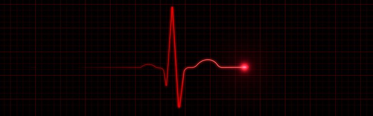 Darstellung Herzfrequenz auf schwarzem Hintergrund - Bedeutung Herzkreislauf-Erkrankungen