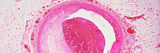 Darstellung einer Zelle in rosa
